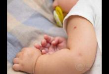 寶寶“秋凍”須把握這4項指標