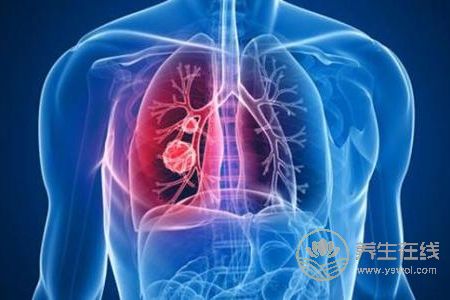 老年人霜降如何養生?老年人霜降如何預防肺炎呢?-易網健康養生網 老年人霜降如何養生?老年人霜降如何預防肺炎呢?