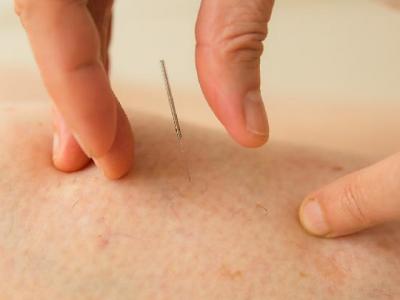 花粉過敏應該如何治療 6方法可有效治療花粉過敏