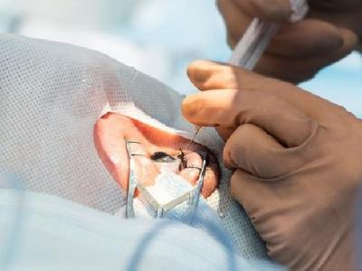 春季鼻炎患者要注意什么事項(xiàng) 鼻炎患者需格外注意這些事項(xiàng)