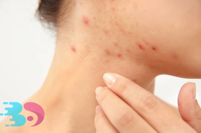 水土不服過敏多久能好，原來它還和身體素質有關!