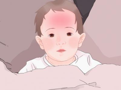 兒童治療中暑小妙招