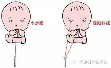 寶寶的視力發育過程及檢查方法