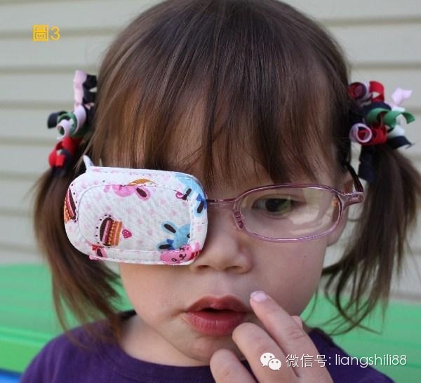 弱視治療防止復發四個要點 弱視治療防止復發四個要點