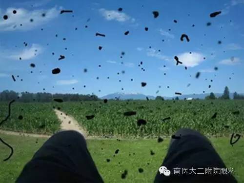 警惕,近視眼更容易得飛蚊癥 警惕,近視眼更容易得飛蚊癥