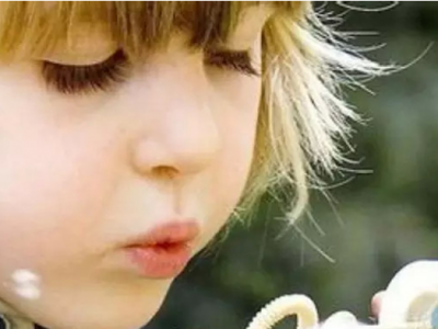 怎樣區別孩子的假性斜視？