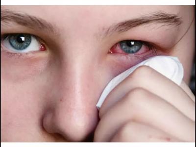 寶寶眼睛紅，是紅眼病嗎？