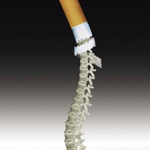 吸煙竟會引起弱視？