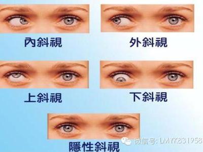 兒童眼病的前兆