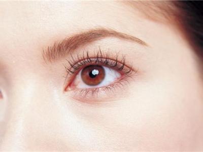 激光近視手術(shù)后遺癥