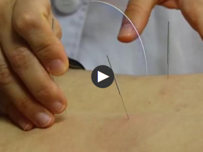 12名葡萄牙“洋中醫”江西進修，“解鎖”中醫新技法