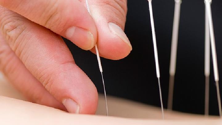 眼角常長斑到底是怎么回事? 雀斑的中醫針灸療法介紹-易網健康<a href=http://m.logojc.com/jkys/ target=_blank class=infotextkey>養生</a>網 眼角常長斑到底是怎么回事? 雀斑的中醫針灸療法介紹