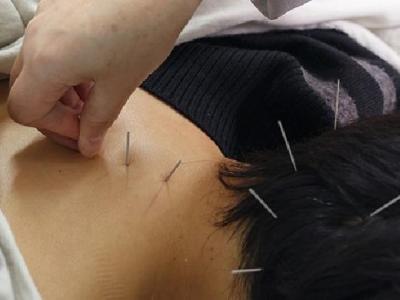 中醫針灸美容原理是什么 中醫針灸美容的4大操作步驟