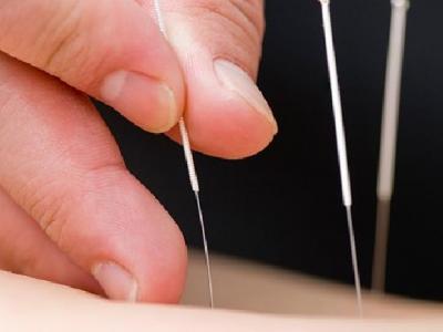 中斷性交容易導致男人陽痿! 中醫(yī)針灸可以治療陽痿嗎