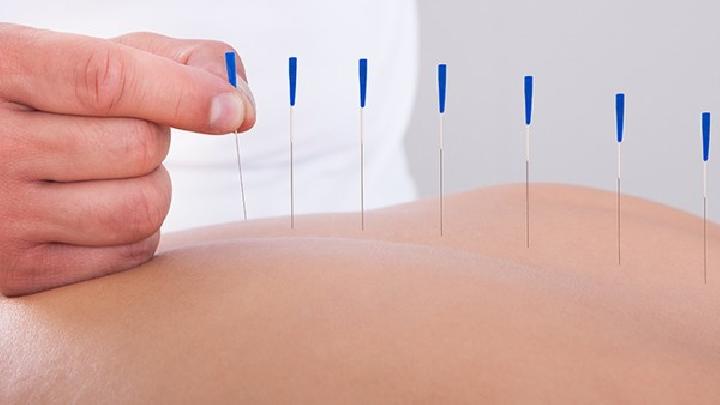 癌癥的針灸治療有什么作用 中醫針灸療法抗癌的特點和優勢