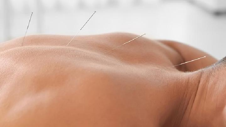 教師群體易患干眼癥該怎么治療 得了干眼癥不妨試試針灸療法