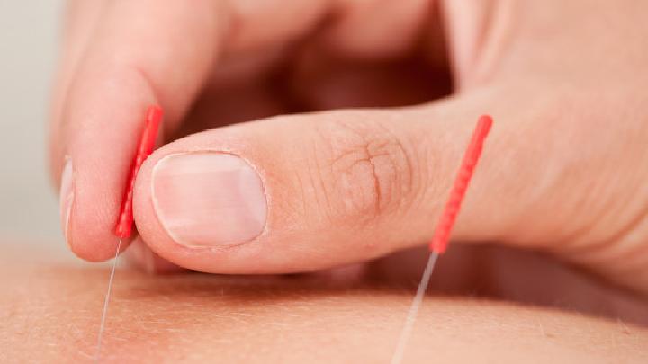 癌癥的針灸治療有什么作用 中醫針灸療法抗癌的特點和優勢-易網健康養生網 癌癥的針灸治療有什么作用 中醫針灸療法抗癌的特點和優勢