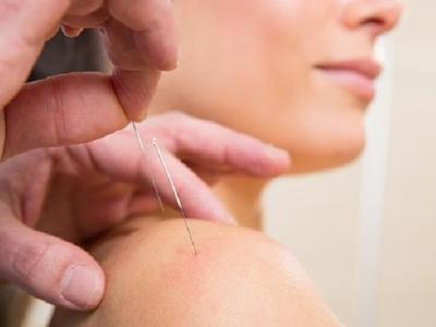 中醫(yī)針灸治療耳聾的方法是什么 4個(gè)中醫(yī)解決耳聾針灸治療方法