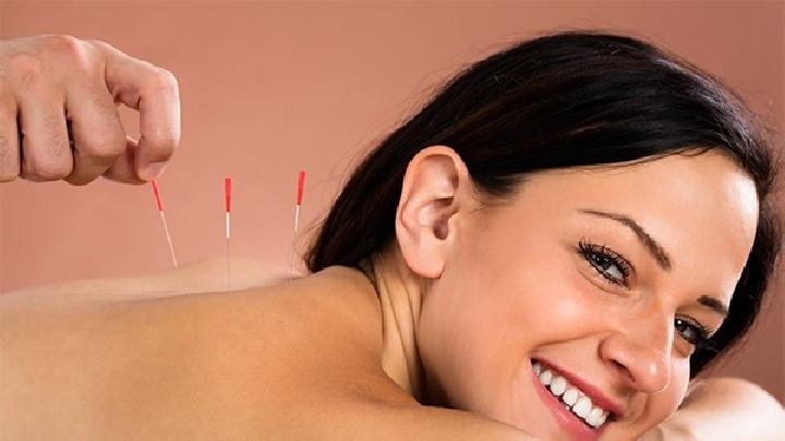 為什么男性婚后更易發生脫發 中醫針灸助男士防脫發效果佳