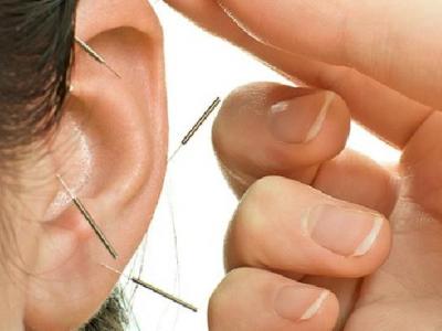 鼻炎頻發中醫有什么好的治療辦法 中醫針灸按摩治療鼻炎頻發效果好
