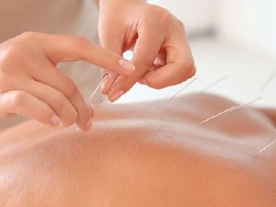 女性痛經怎么才能快速止痛 女性痛經用針灸扎穴位止痛最快