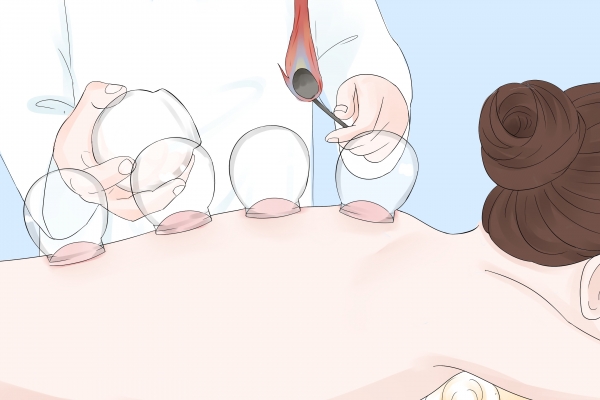 拔火罐有什么好處