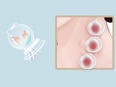 拔罐后多久可以吹空調